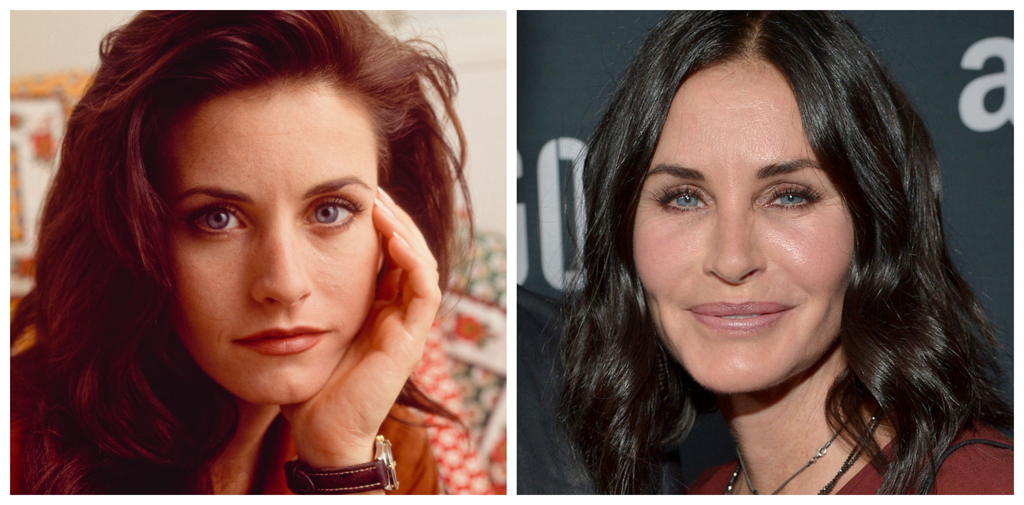 Friends star Courtney Cox underwent a series of cosmetic treatments which she later had dissolved. Photos / Getty Images