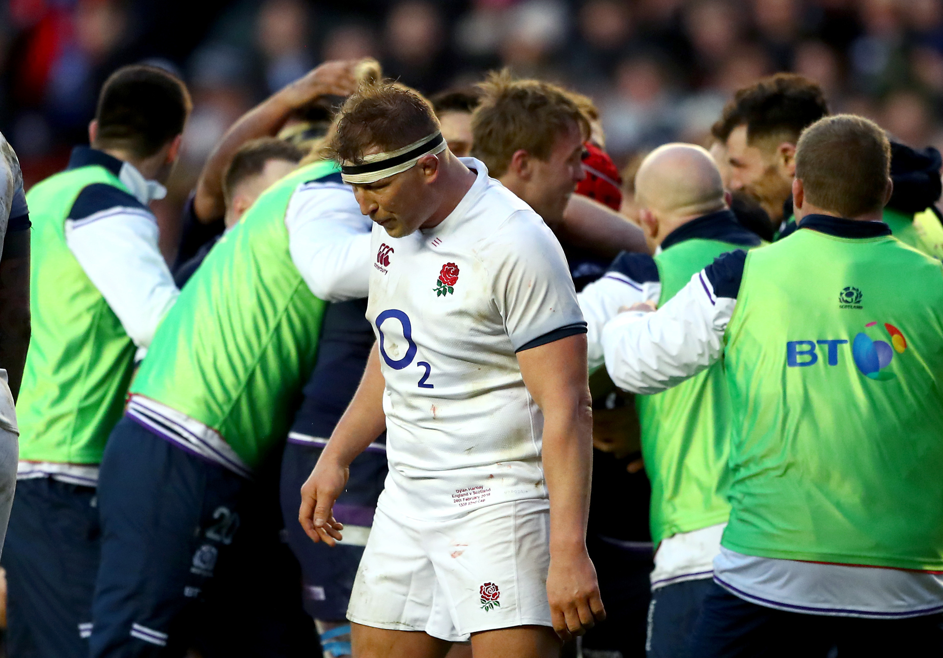 what-is-the-lump-in-the-back-of-rugby-players-shirts-bios-pics