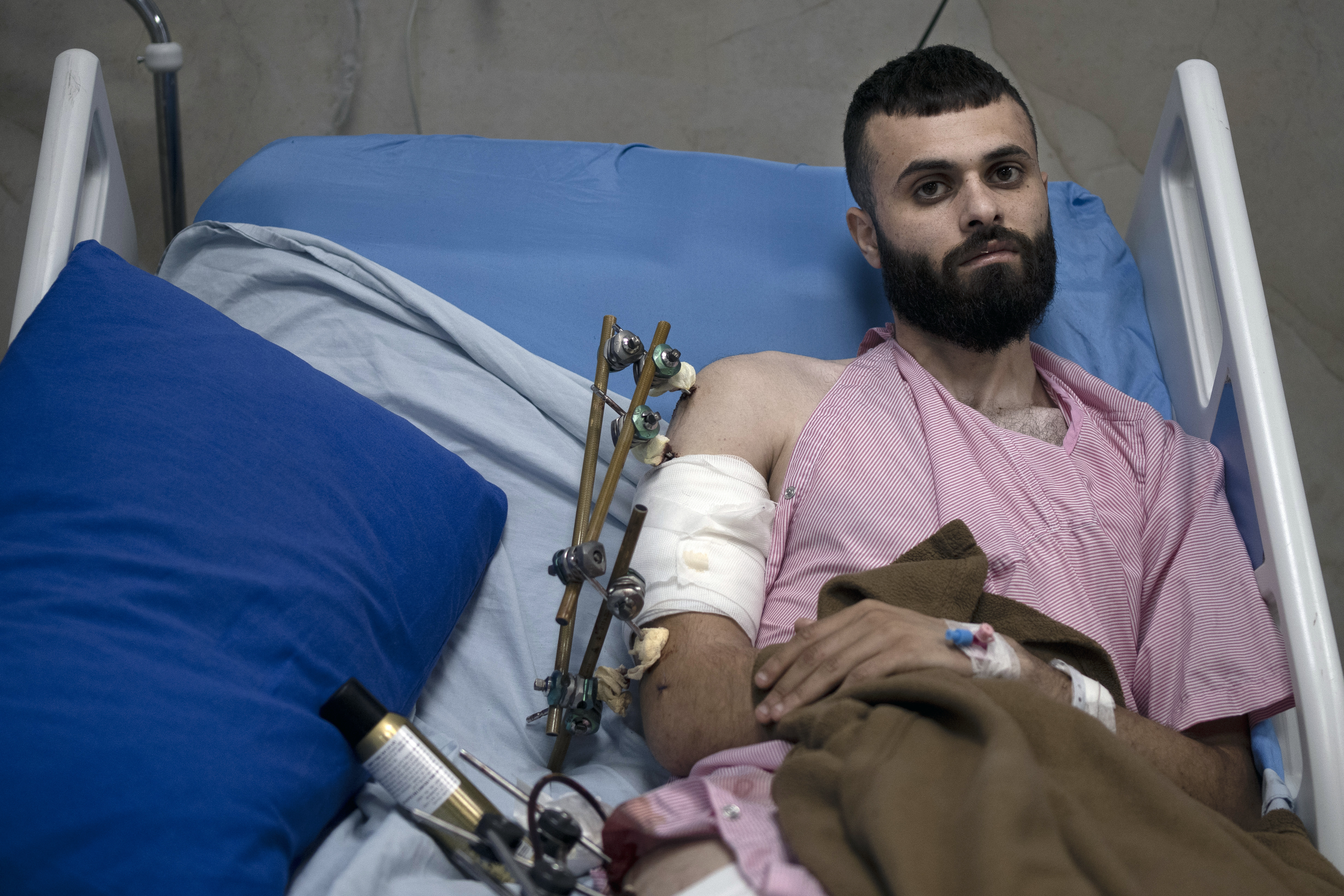 Mujahid Abadi is recovering from gunshot wounds and burns in the West Bank city of Jenin. Photo / AP
