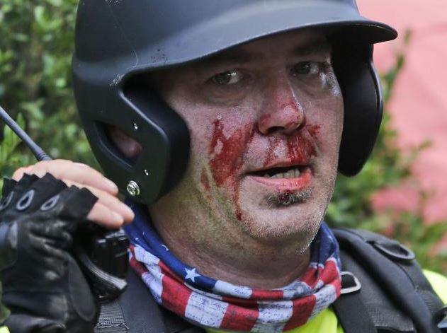 A white nationalist demonstrator, bloodied after a clash with a counter demonstrator, talks on the radio receiver at the entrance to Lee Park in Charlottesville. Photo: AP Photo/Steve Helber