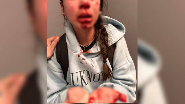 A girl, 13, was beaten at a Rotorua bus stop outside the library last week. 