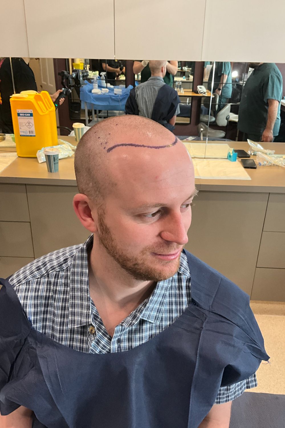 Liam's designer hairline. Photo / Supplied