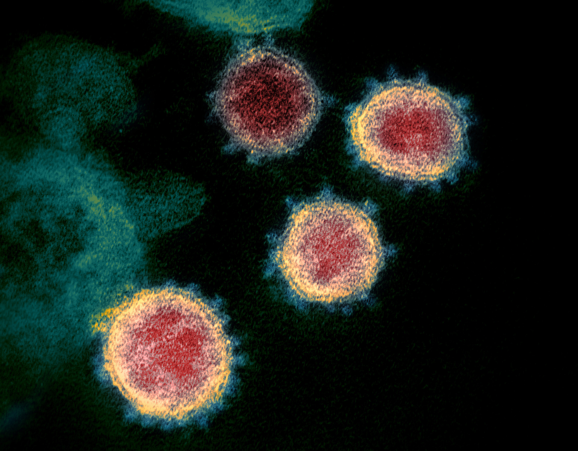 People with Covid-19 are most infectious about two days before symptoms begin and for five days after, according to a new analysis of previous research. Image / NIAID