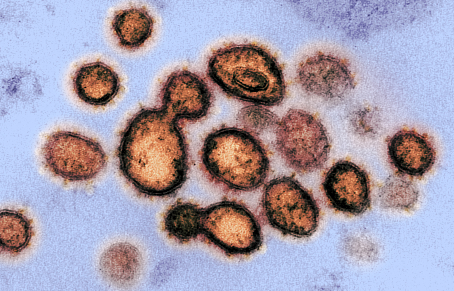 A heavily-mutated Omicron subvariant causing a global stir is yet to pop up in New Zealand – but an ESR scientist expects it’s just a matter of time before it’s detected here.