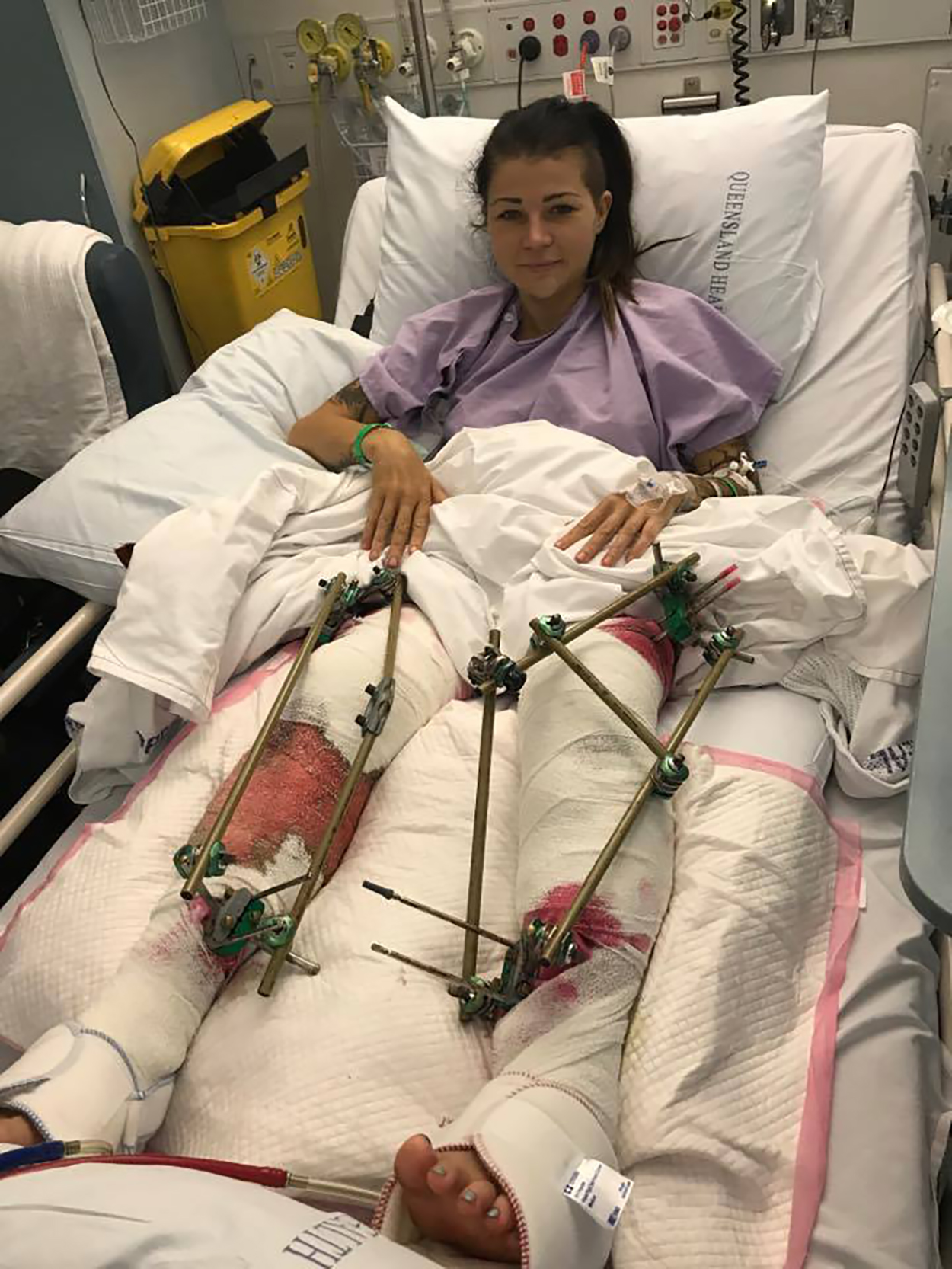 Kiwi woman's legs crushed in horror smash in Queensland - NZ Herald