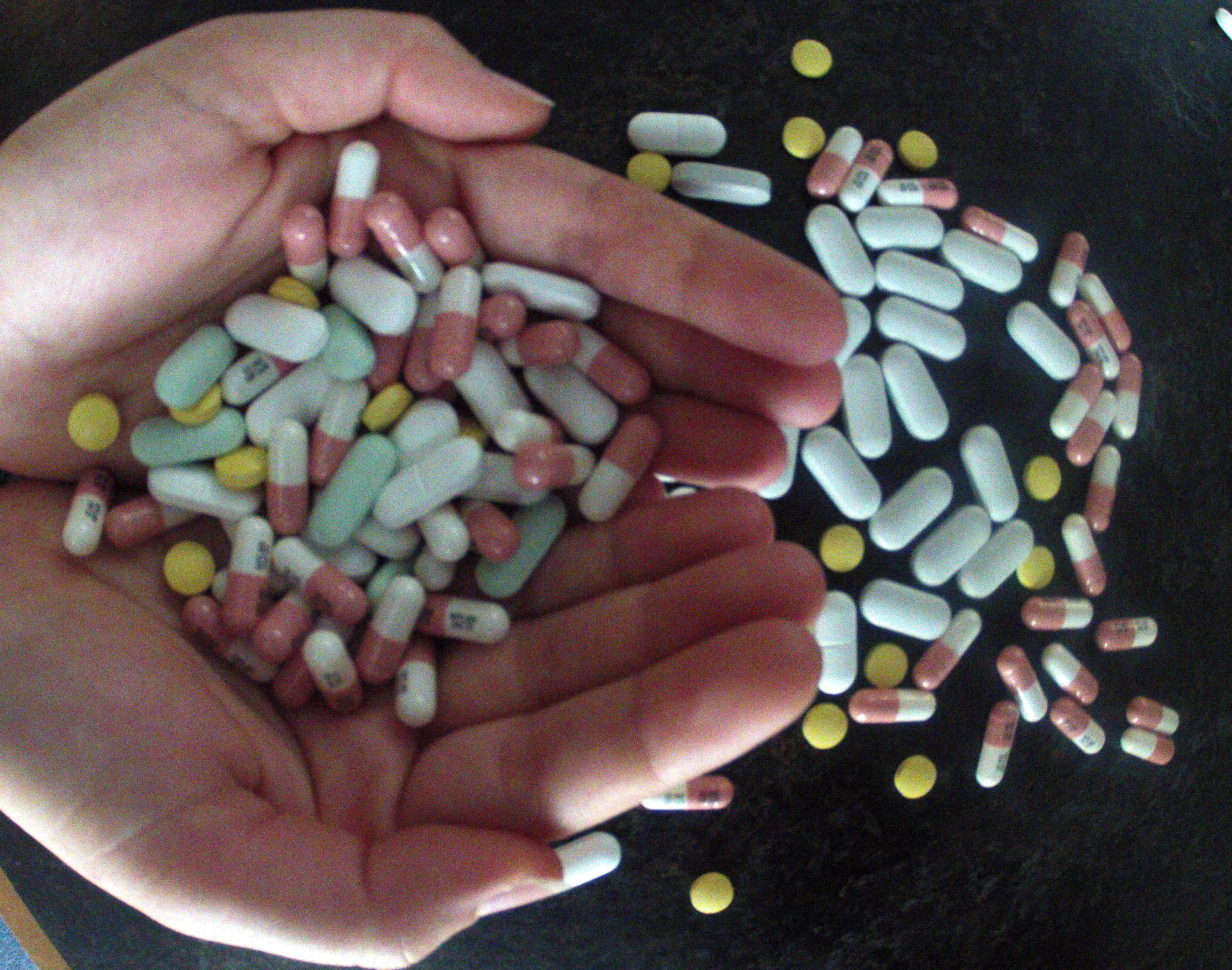 The jury is out on the efficacy of probiotic supplements. Photo / NZME