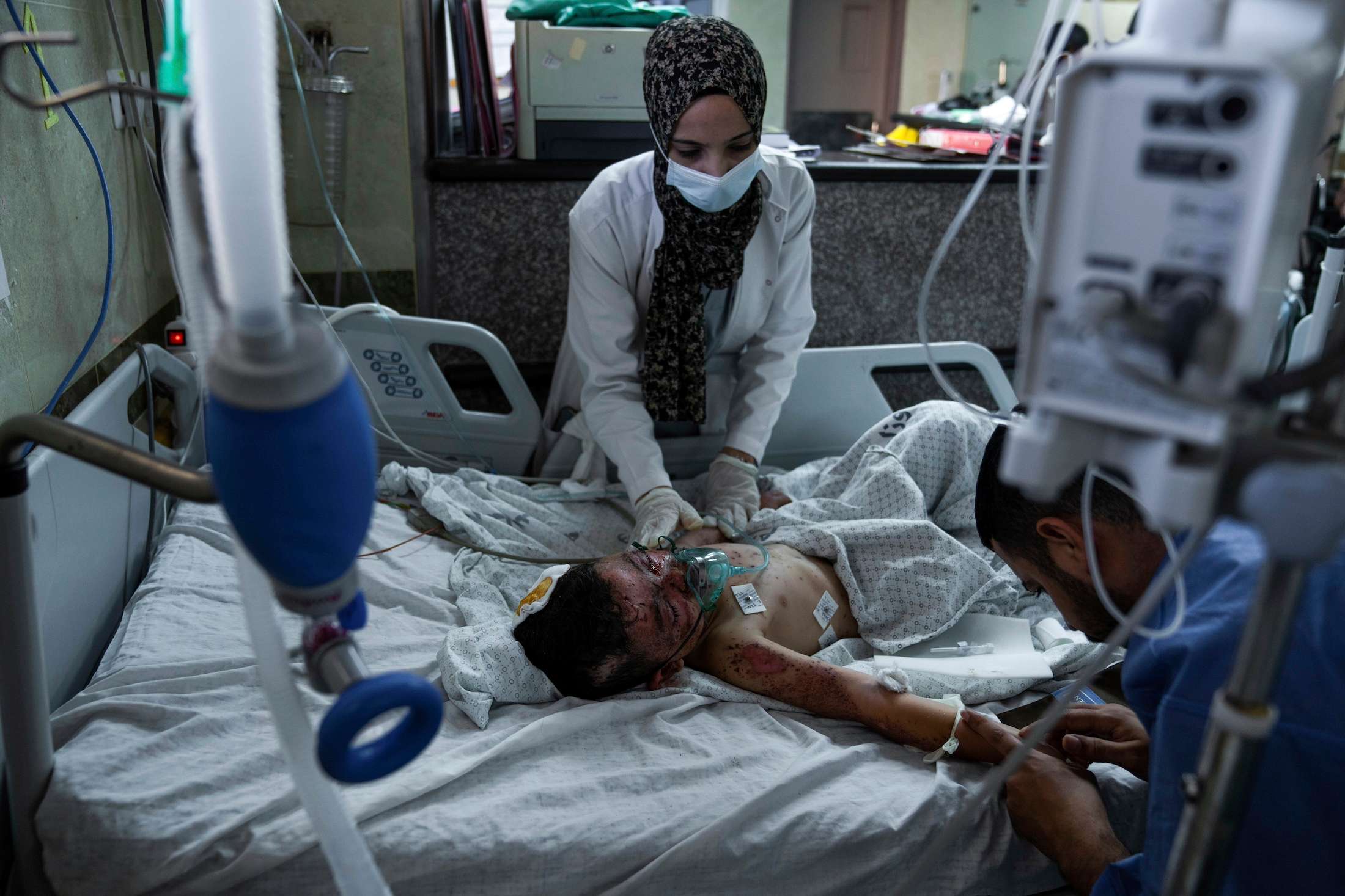 A Palestinian boy wounded during an Israeli airstrike receives medical treatment at Nasser Hospital in Khan Younis, Gaza Strip. Photo / AP
