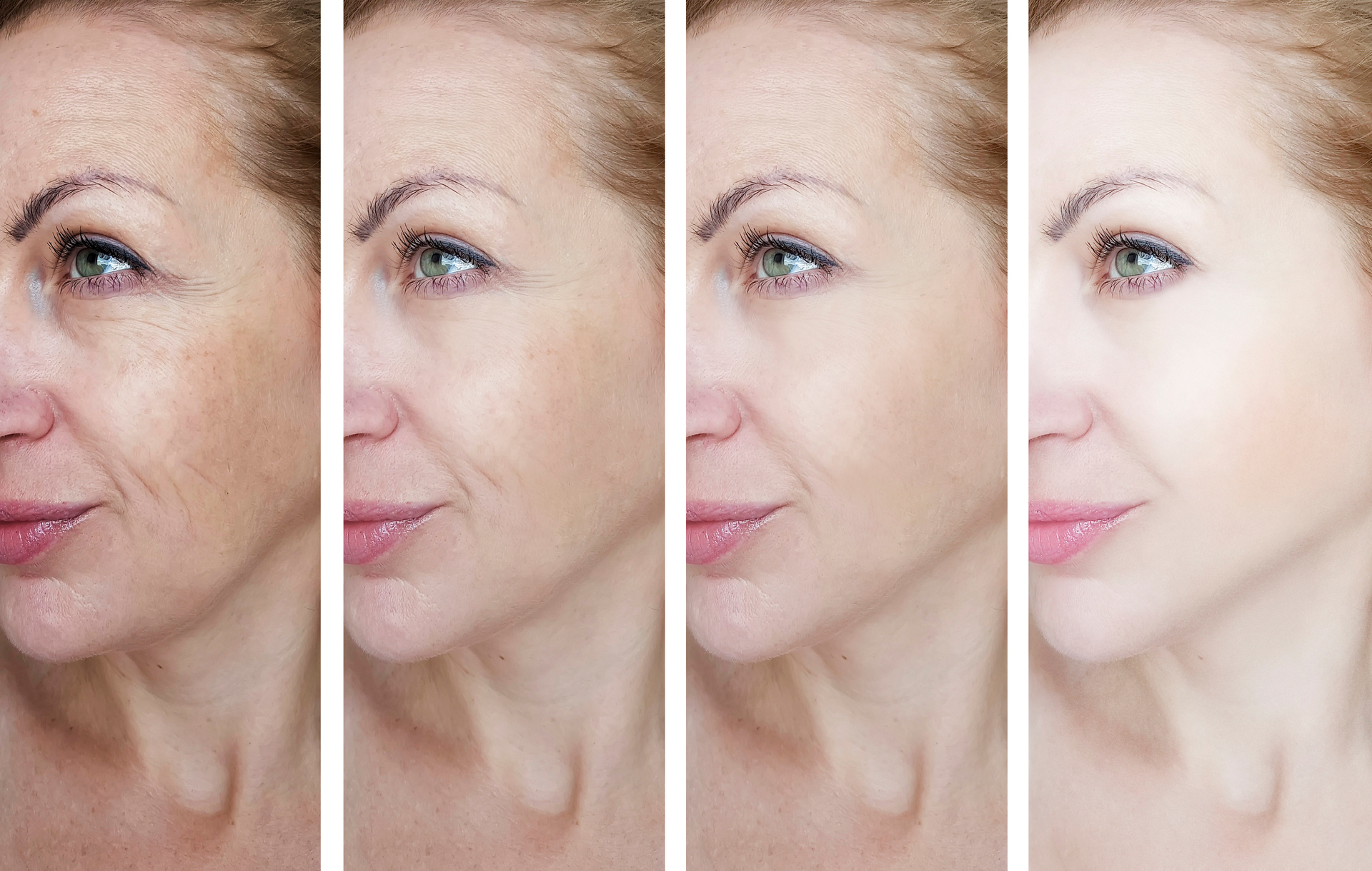 Before and after photos should only be of the work of the practitioner advertising them. Photo / Getty Images