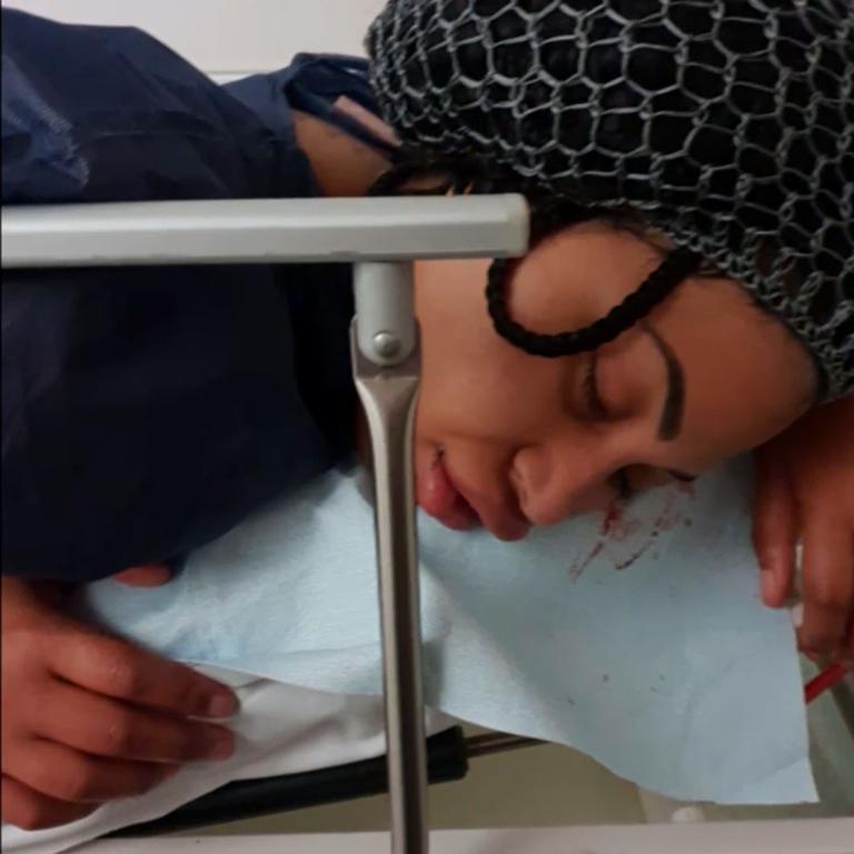 Keisha Amoah, 26, says she had to call an ambulance for herself following a liposuction and a Brazilian butt lift procedure. Photo / 60 Minutes/Channel 9
