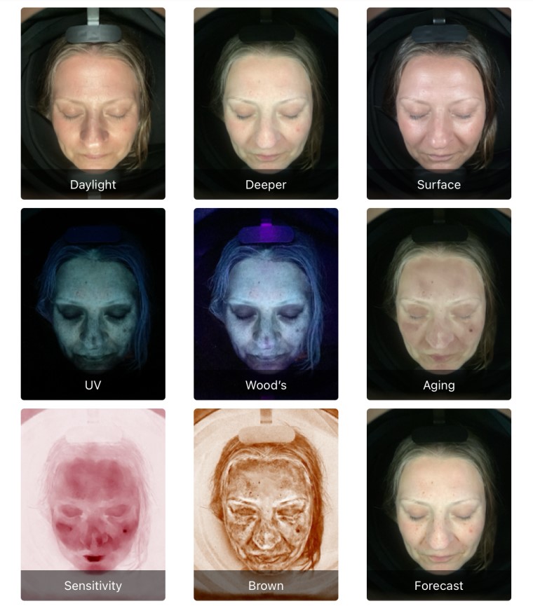 The spa uses skin analysis technology to assess your skin before treatment.