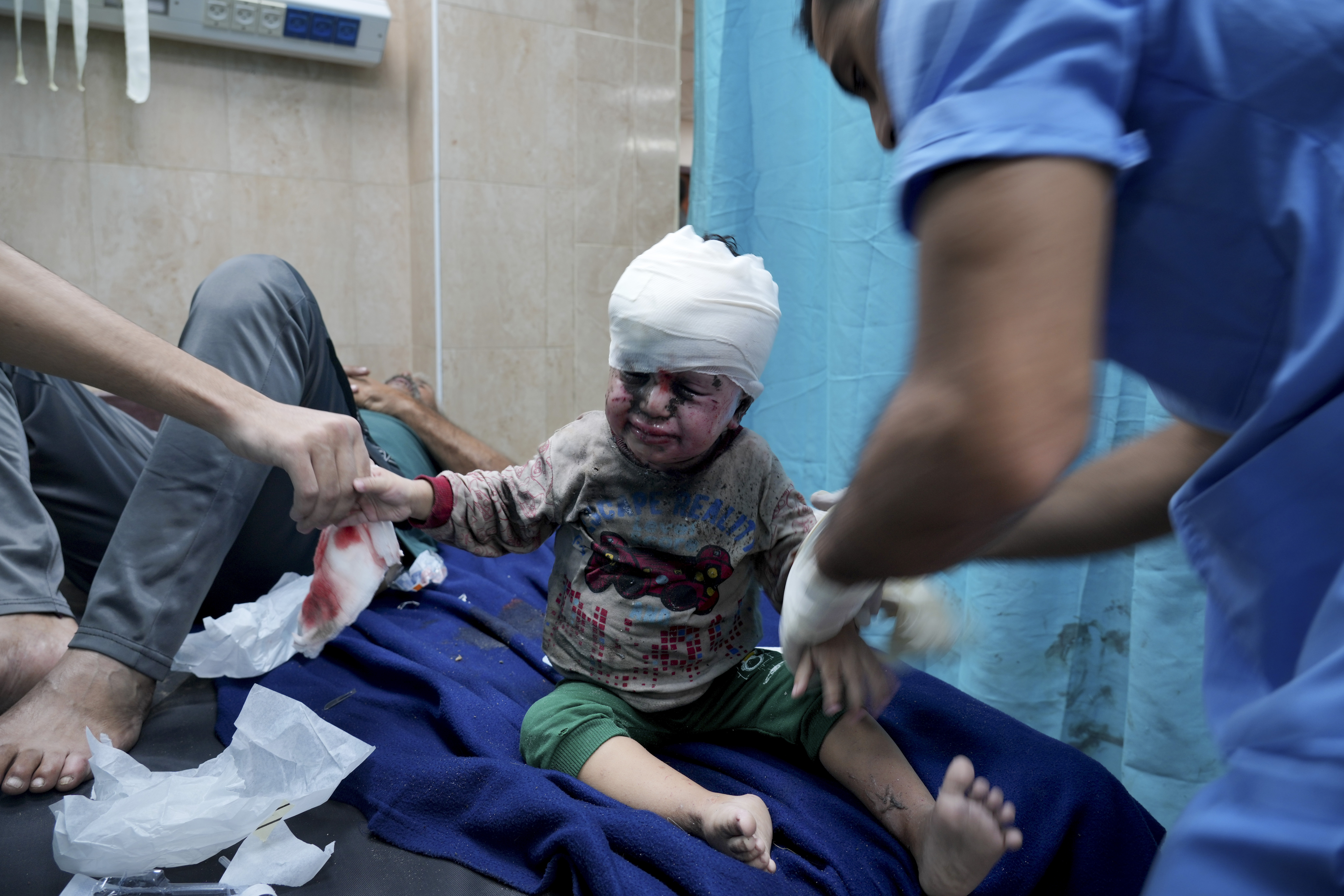 Palestinian child wounded in Israeli bombardment is treated in a hospital in Deir al Balah, south of the Gaza Strip. Photo / AP