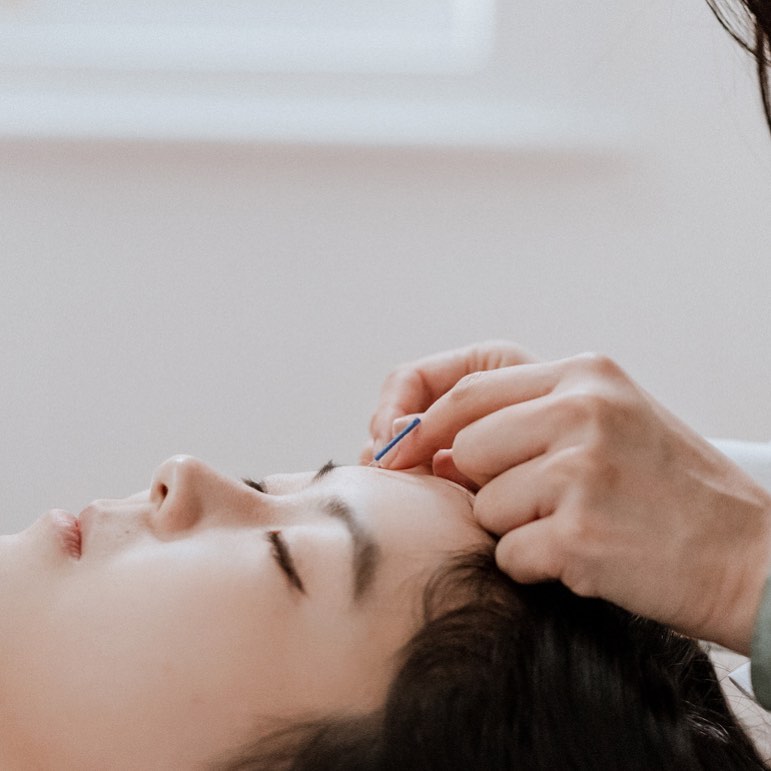 At Origins, they use a thing needle (between 0.10mm to 0.14mm) for a painless treatment. Photo / @Originsacu_nz