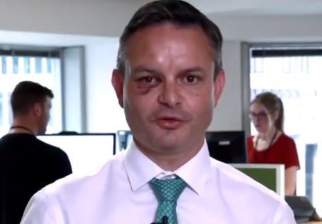James Shaw's black eye today.