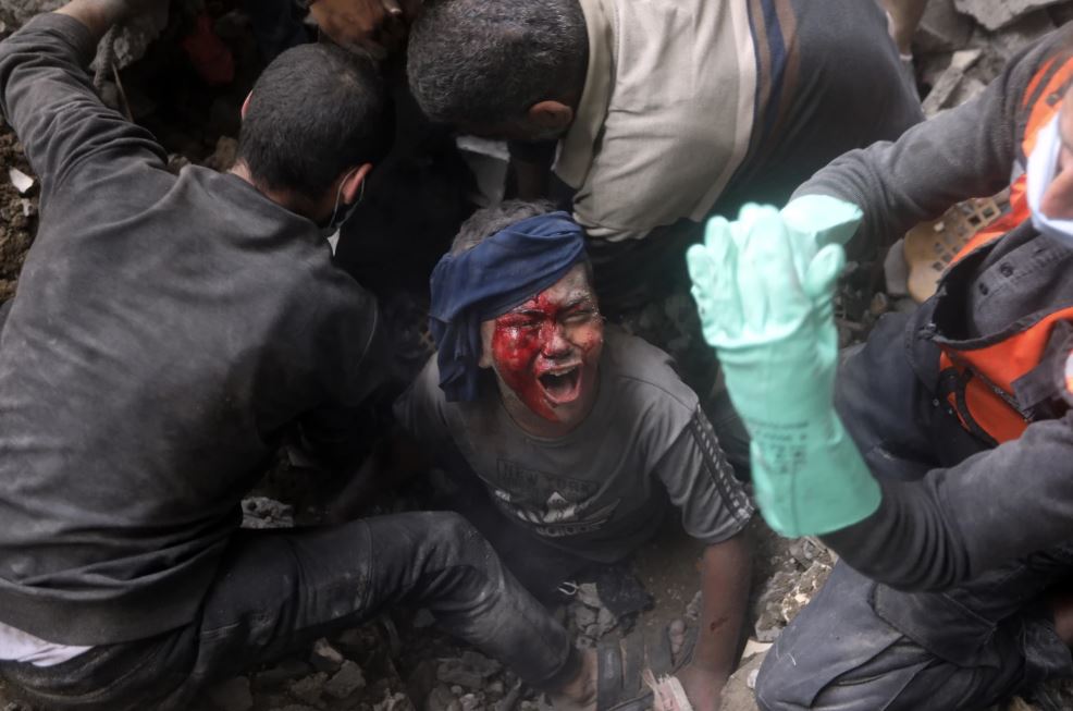 An injured Palestinian boy cries as rescuers try to pull him from the rubble of a destroyed building following an Israeli airstrike in Bureij refugee camp, Gaza Strip. Photo / AP
