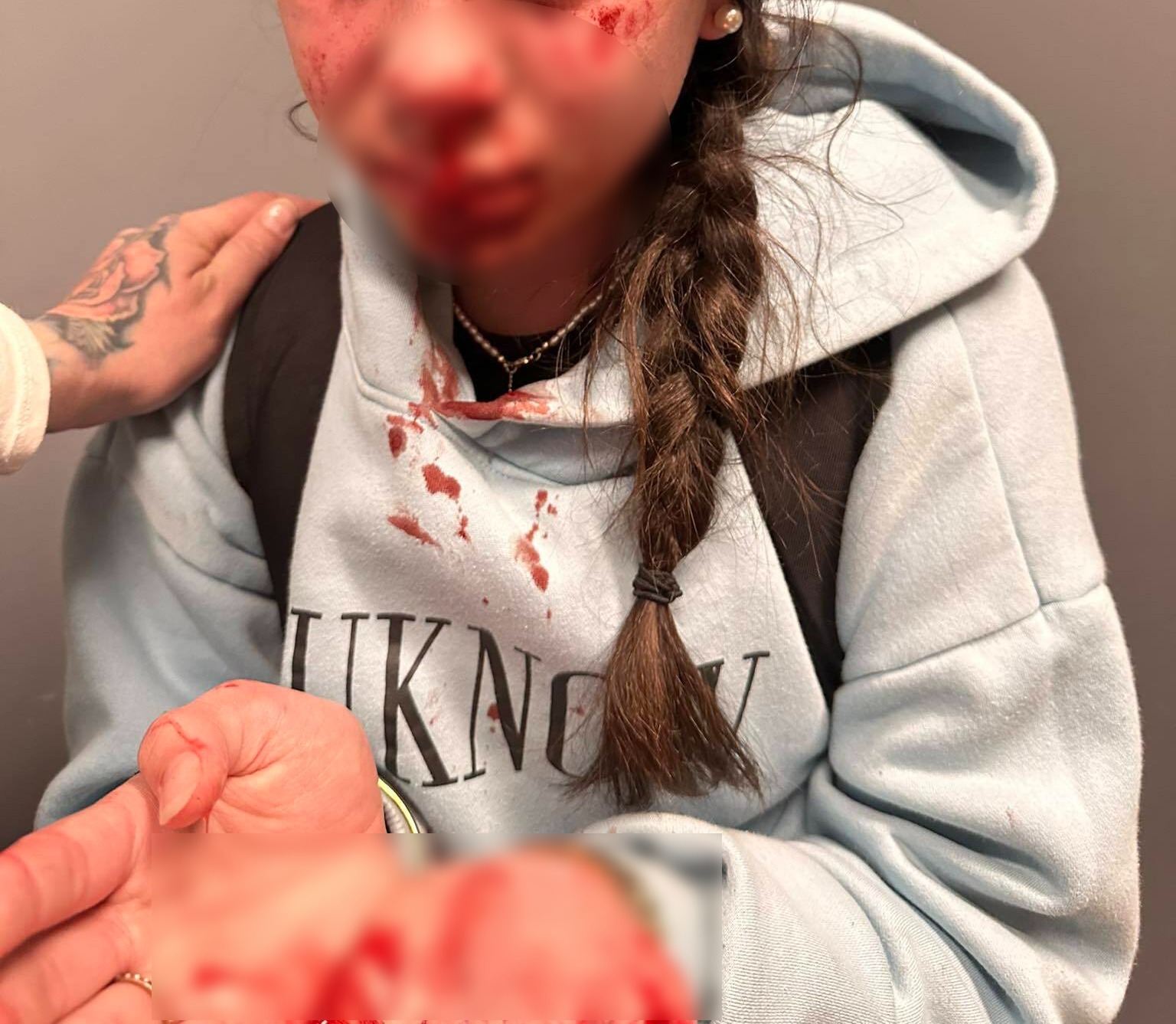 The girl did not know her attacker, her mother says. 