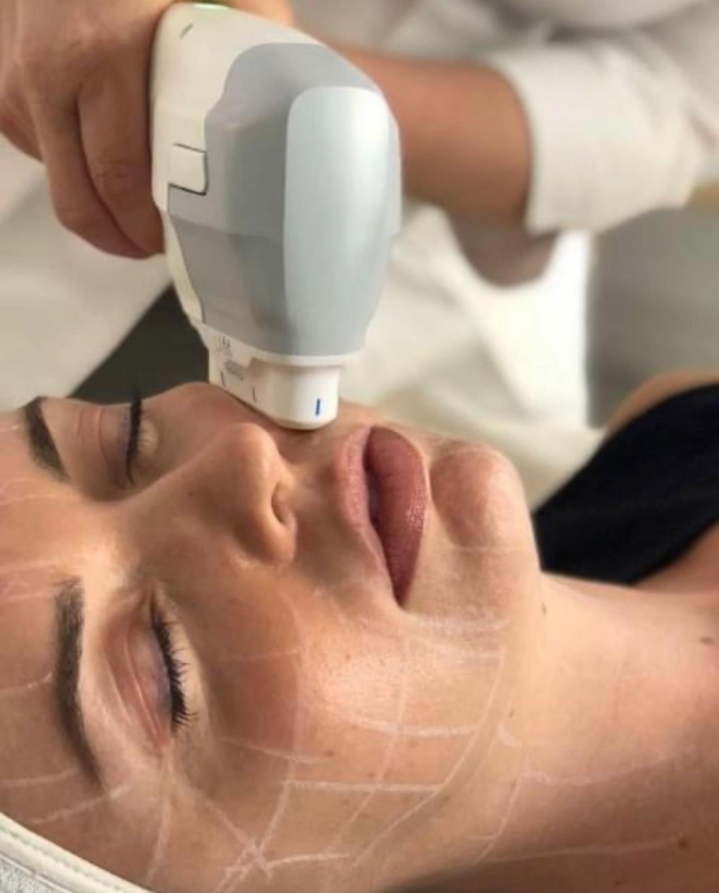 Treat your skin to some ultra treatment for summer - NZ Herald