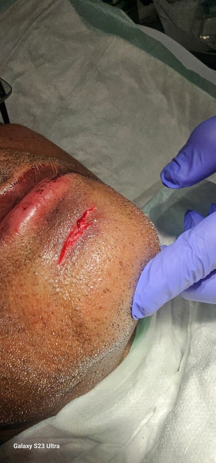 The gaping wound after the violent attack was almost through to the other side of the skin, according to Trehan's wife.