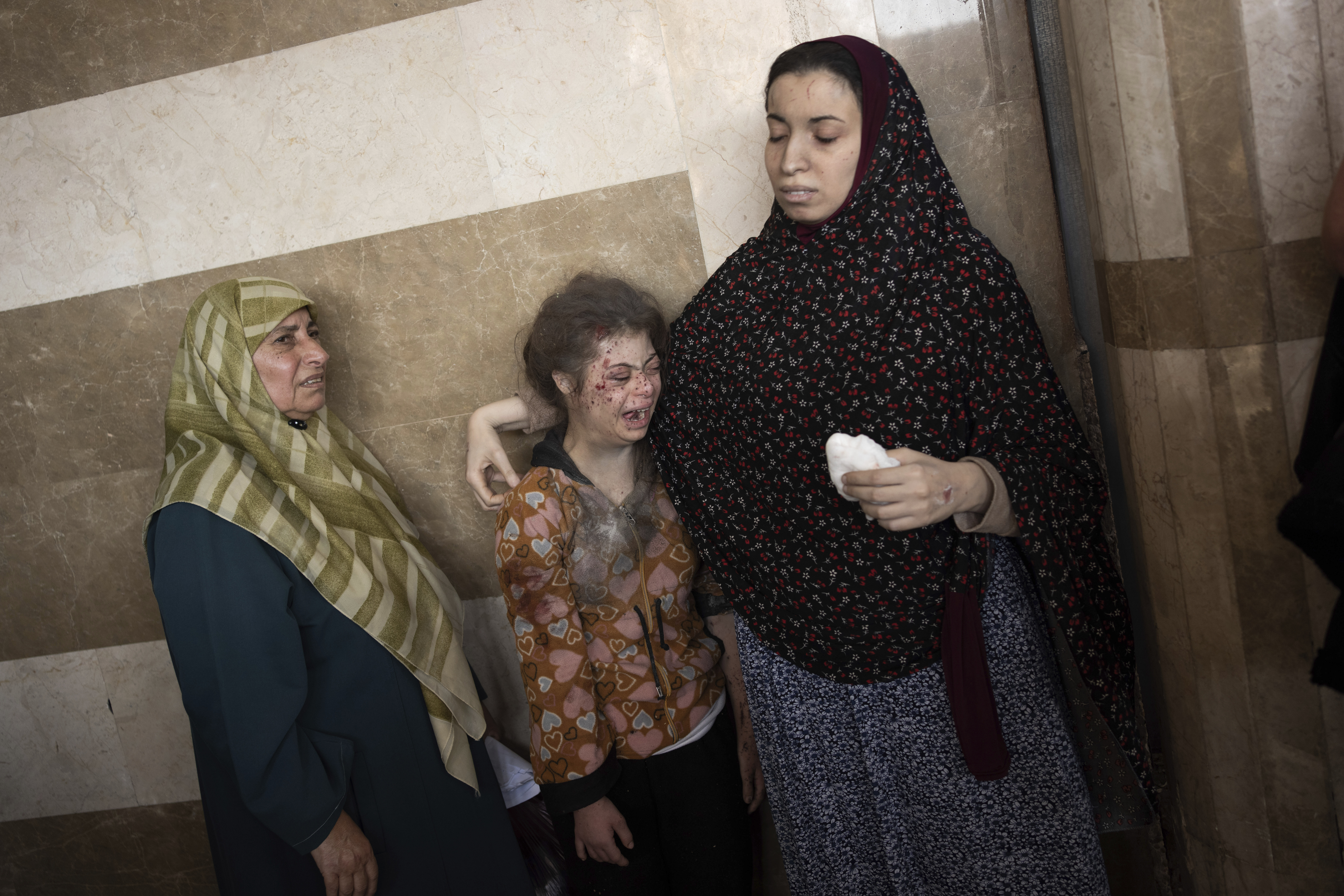 A Palestinian girl wounded in Israeli bombardment of the Gaza Strip is brought to a hospital in Khan Younis. Photo / AP
