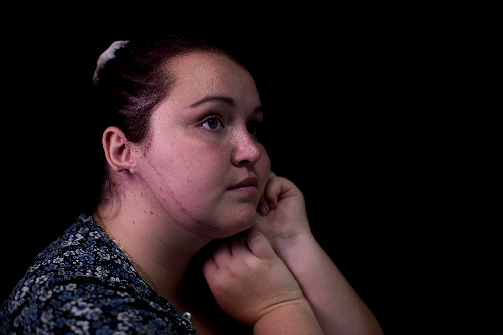 Ezmeralda Johns suffered multiple stab and laceration wounds - including to her neck - in the September 2021 terror attack at an Auckland supermarket. Photo / Dean Purcell
