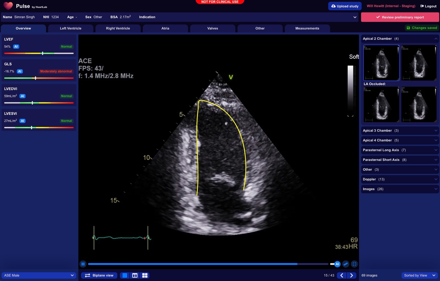 HeartLab's Pulse platform, which uses AI to automate analysis of echocardiograms. Image / Supplied
