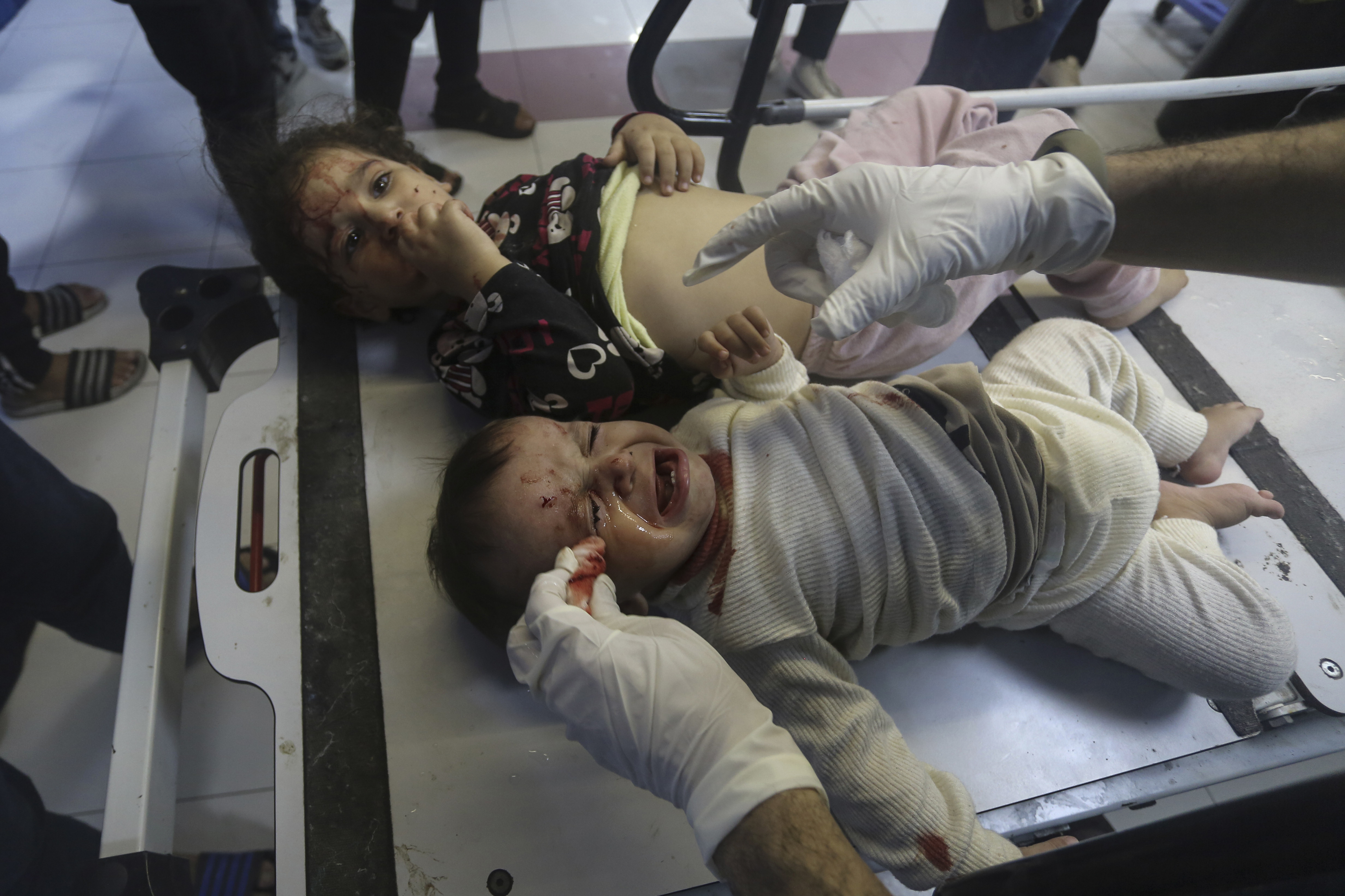 Wounded Palestinian children receive treatment at the al-Shifa hospital, following Israeli airstrikes on Gaza City, central Gaza Strip. Photo / AP