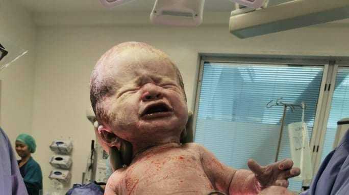 When Daxton Roman was born his head was 45 centimetres. Photo / Supplied 