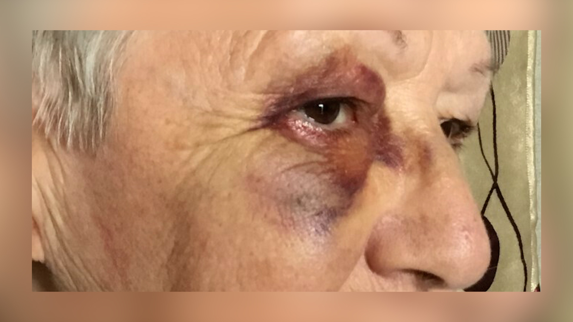 A 72-year-old woman bashed at the Posie Parker rally at Auckland's Albert Park was happy to hear of today's guilty plea.