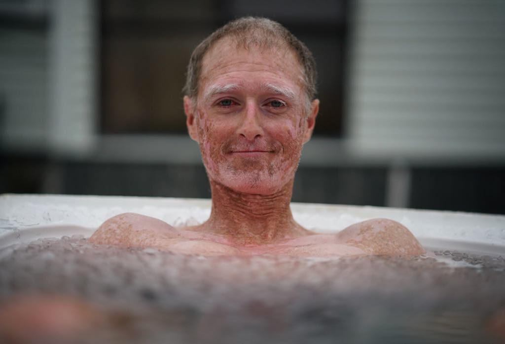 Opinions cool on ice baths - Sport News - NZ Herald