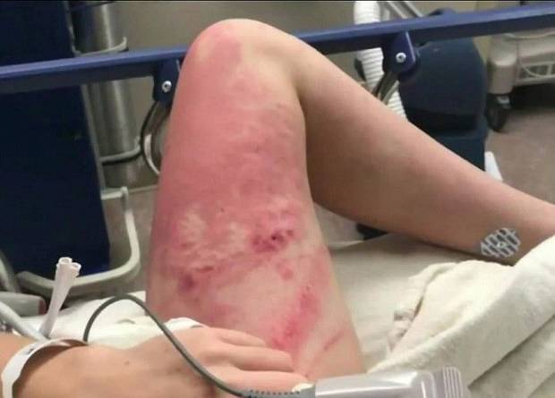 Teen Feels Bad For Pushing Friend Off Bridge May Be Charged Nz Herald
