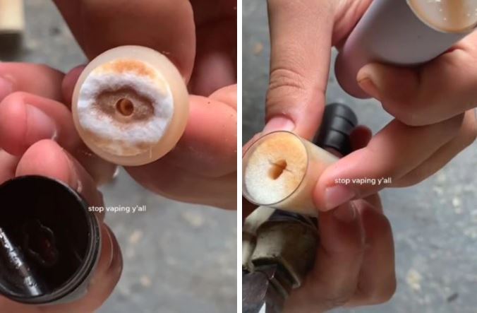 Vaping health risks: Disgusting innards of trendy vaping devices