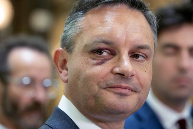 James Shaw suffered a broken bone is his eye socket in the attack. Photo / Mark Mitchell