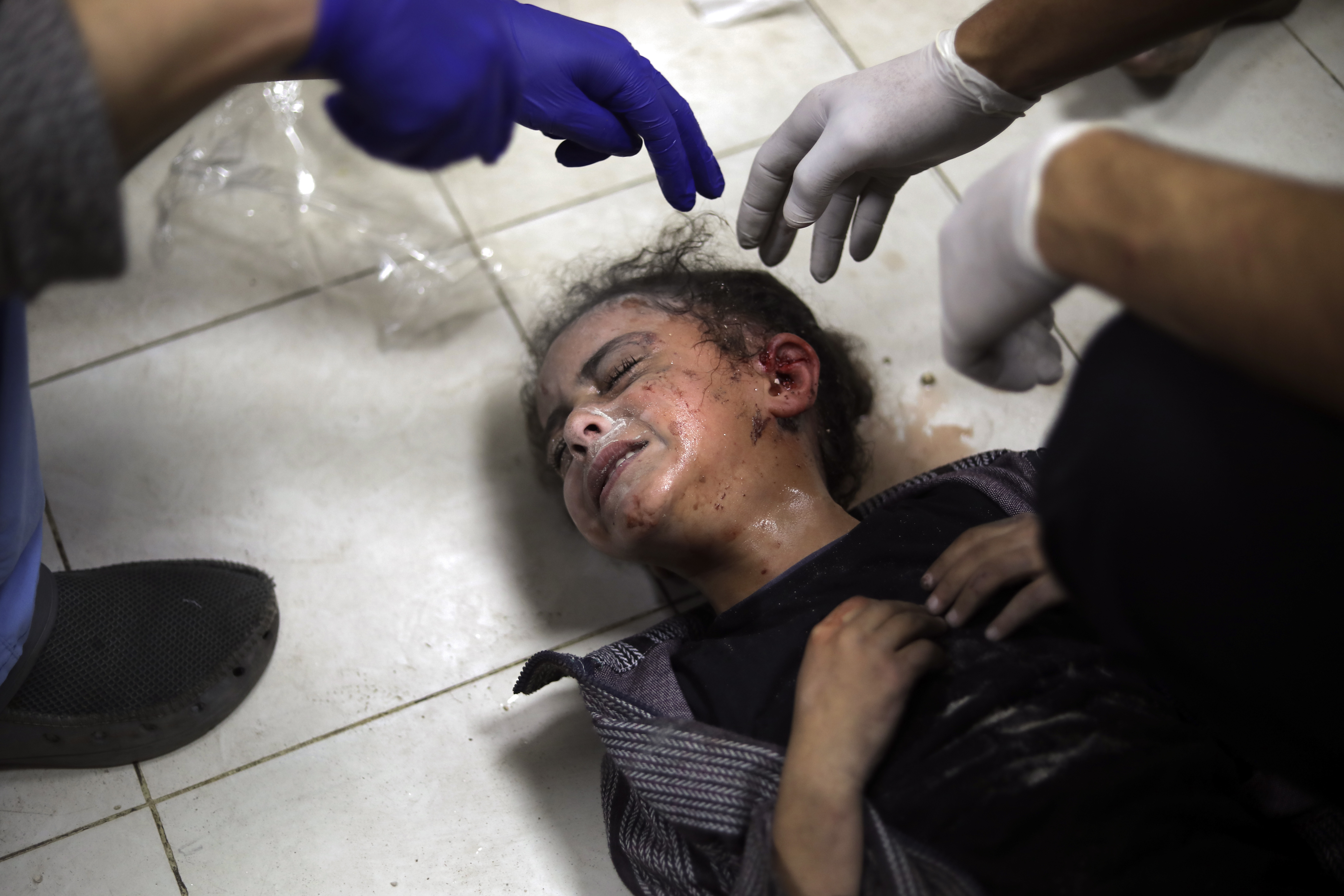 A Palestinian child wounded during the Israeli bombardment of the Gaza Strip receives treatment at the Nasser hospital in Khan Younis, Southern Gaza Strip. Photo / AP