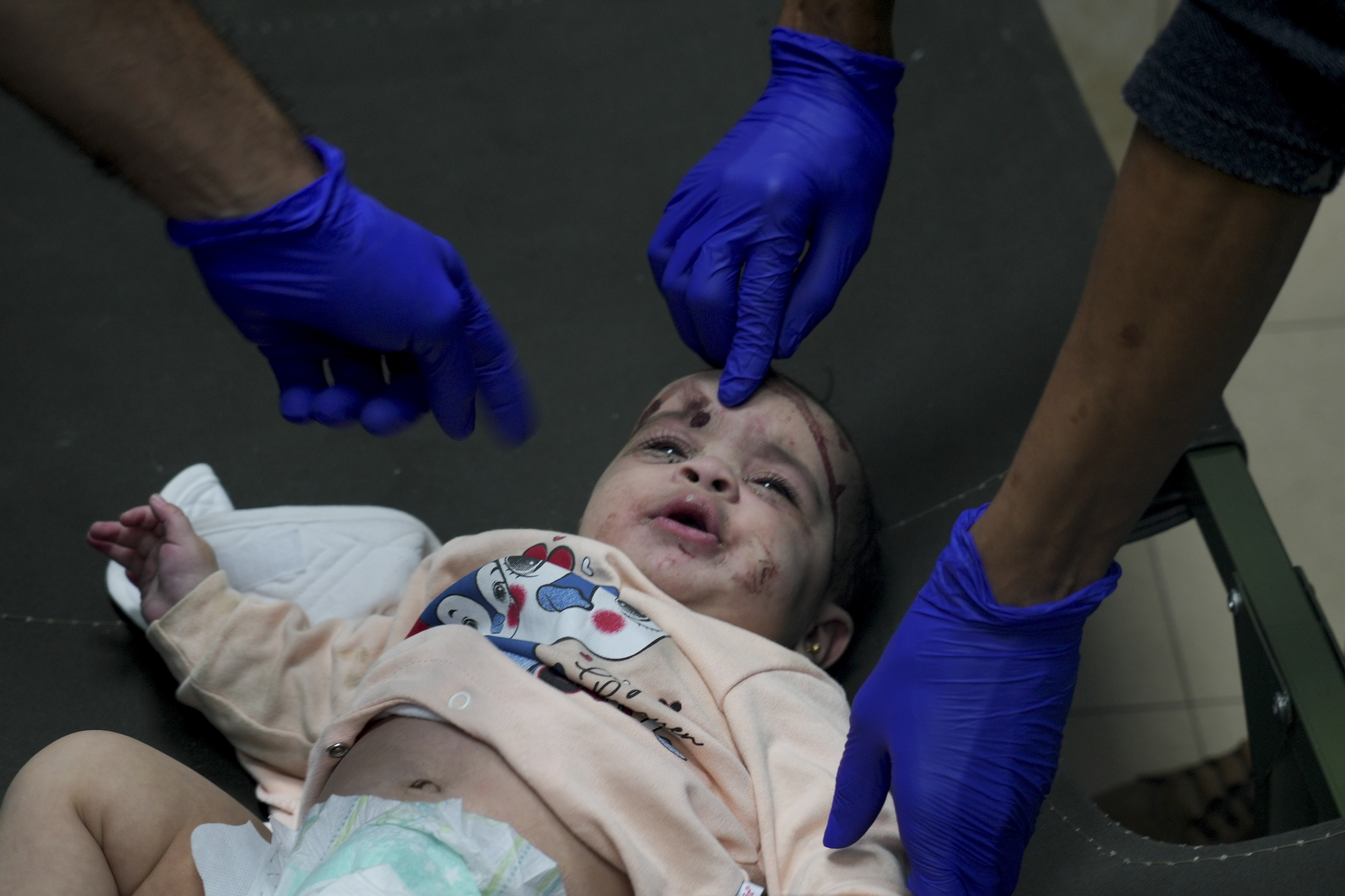 A Palestinian baby wounded in the Israeli bombardment of the Gaza Strip is treated in a hospital. Photo / AP