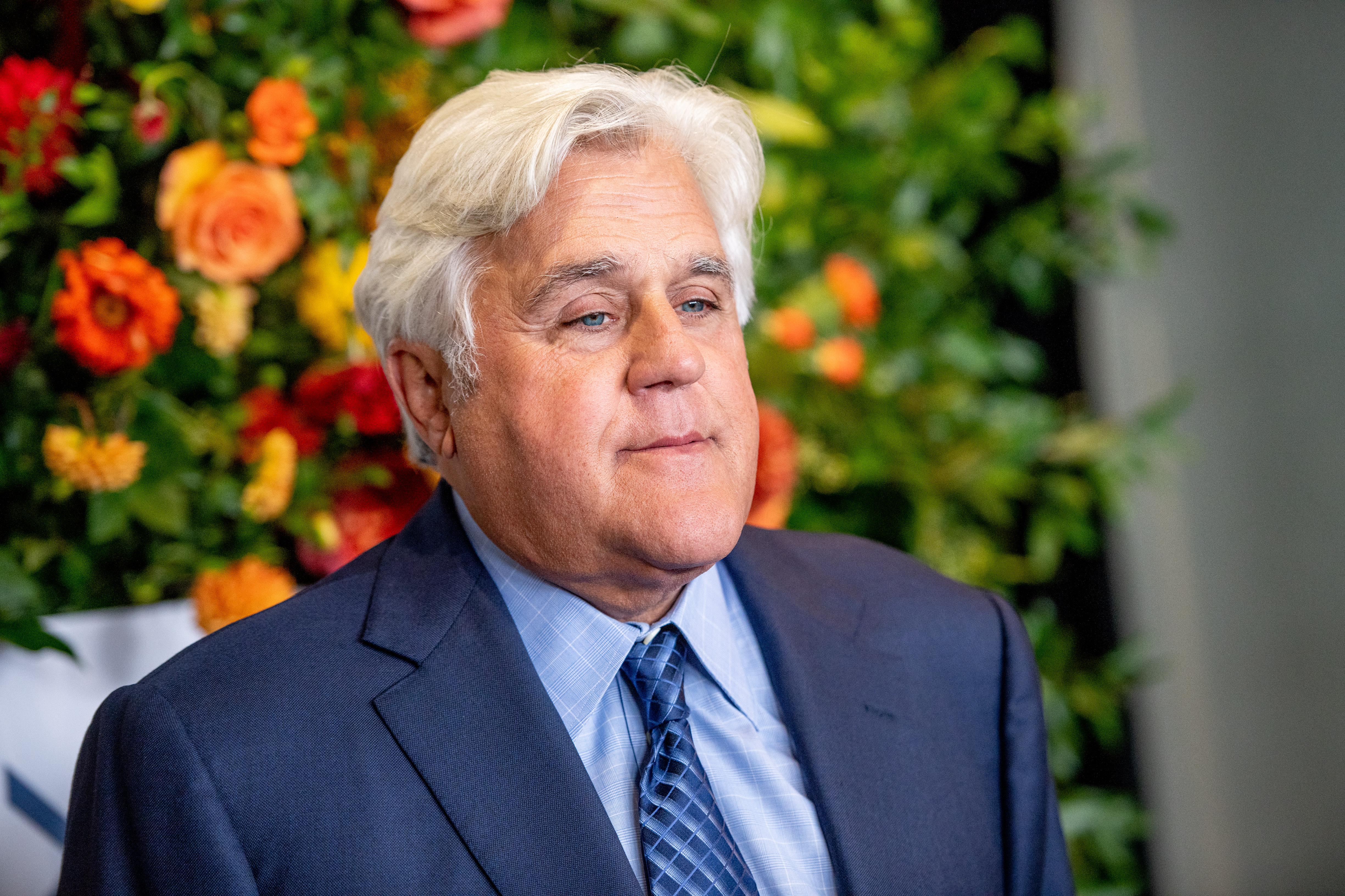 Jay Leno has been hospitalised with serious facial burns.