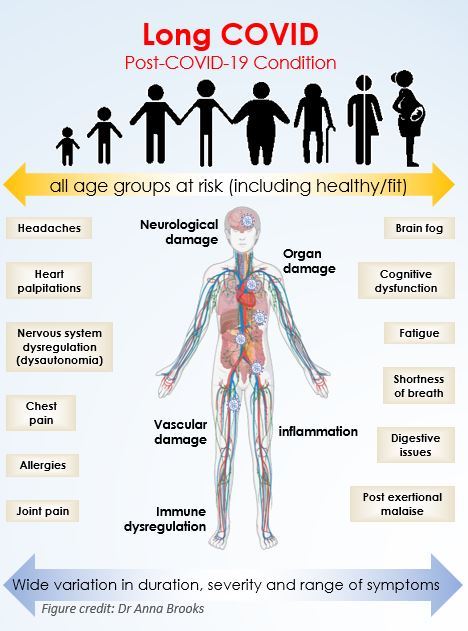 Long Covid can affect people of all ages. Graphic / Dr Anna Brooks