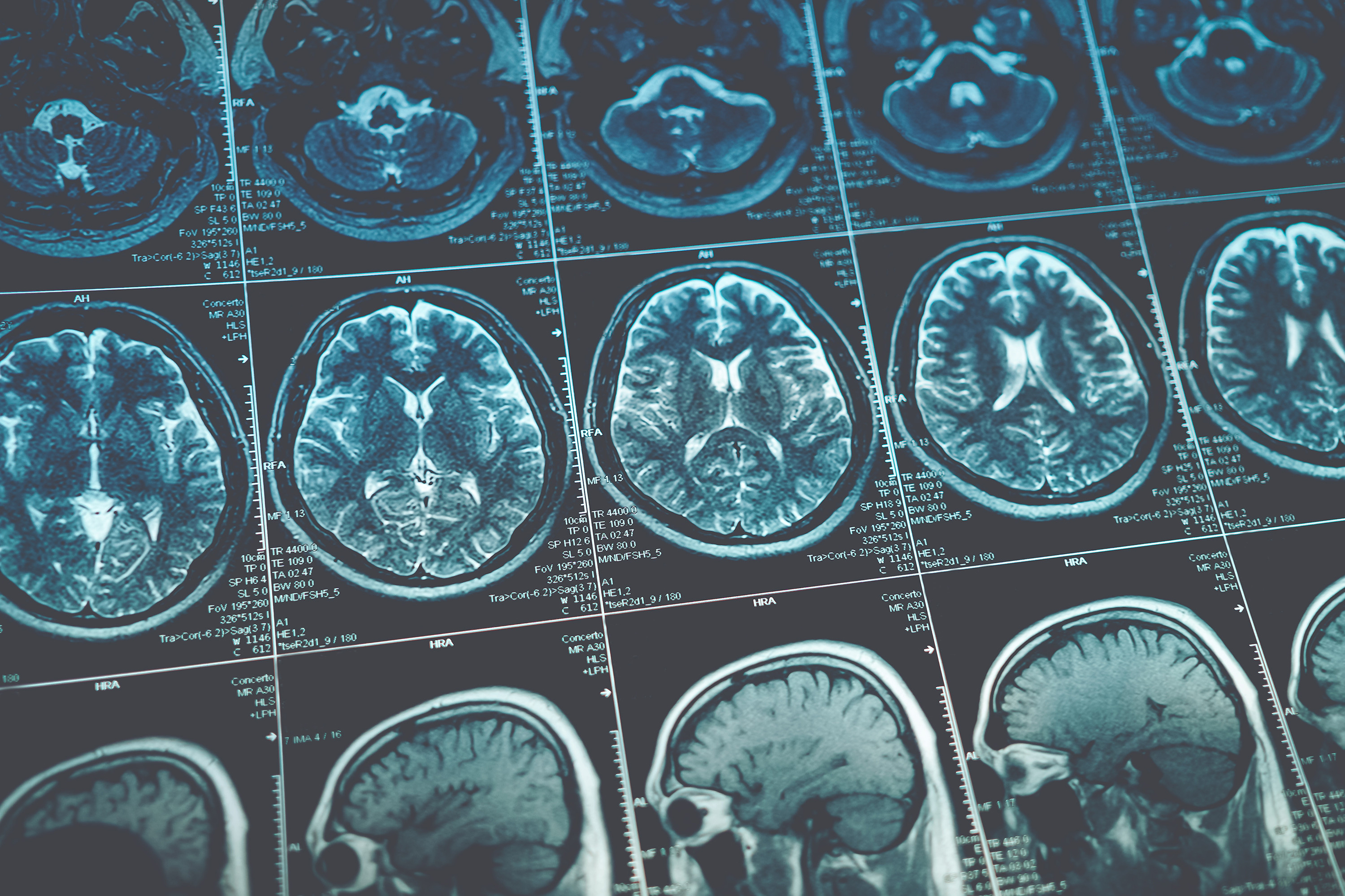 Head injuries in sport have been a topic of concern for years. Photo / 123rf