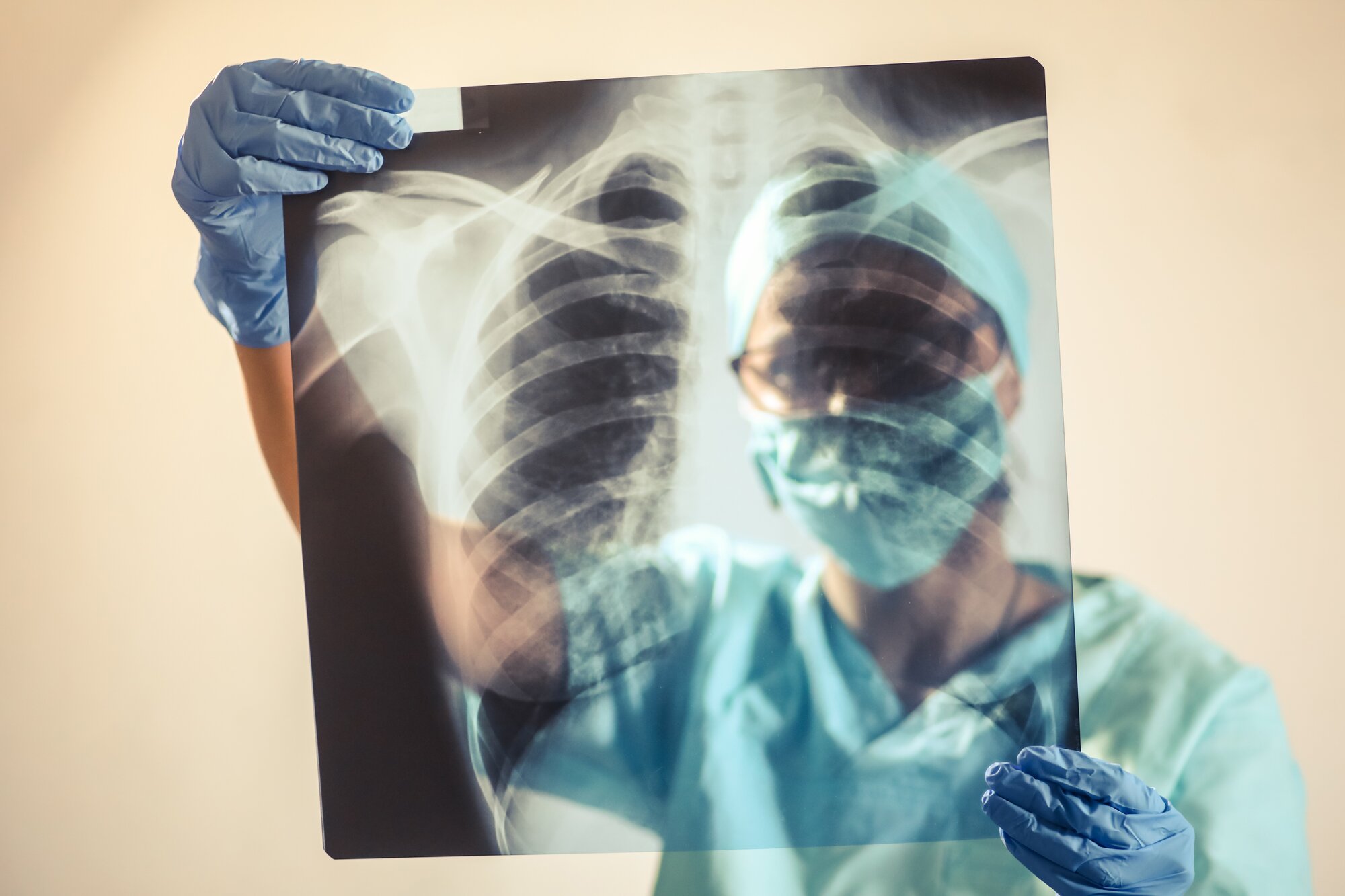 Fears that AI would take the jobs of radiologists have proved to be unfounded. Photo / Supplied