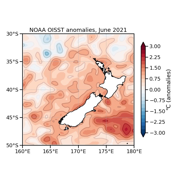 This image shows current sea surface temperatures around New Zealand. Image / Supplied