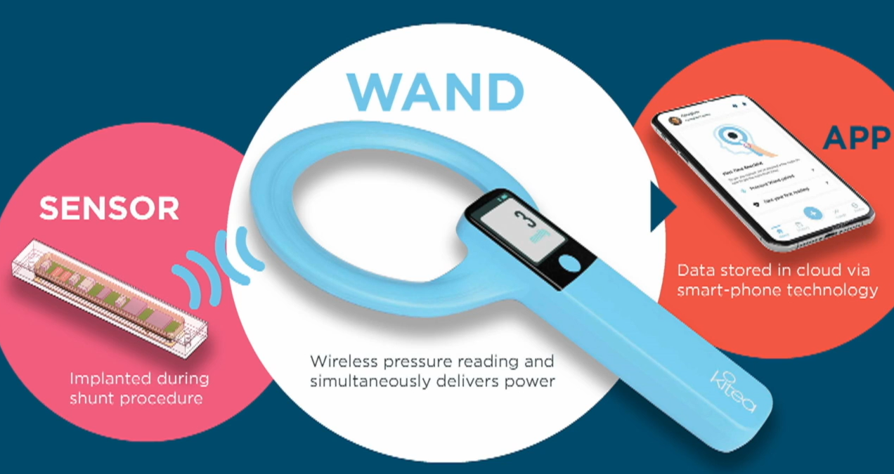 A “wand” is used to take wireless pressure readings from Kitea's sensor. It only takes 15 seconds, and involves nothing more complicated than holding the wand within a few centimetres of your (or our child’s) head. Readings are diarised in an app to reveal trends. Encrypted data can be shared with a doctor via the cloud. It can all be done daily from home. Image / Kitea Health