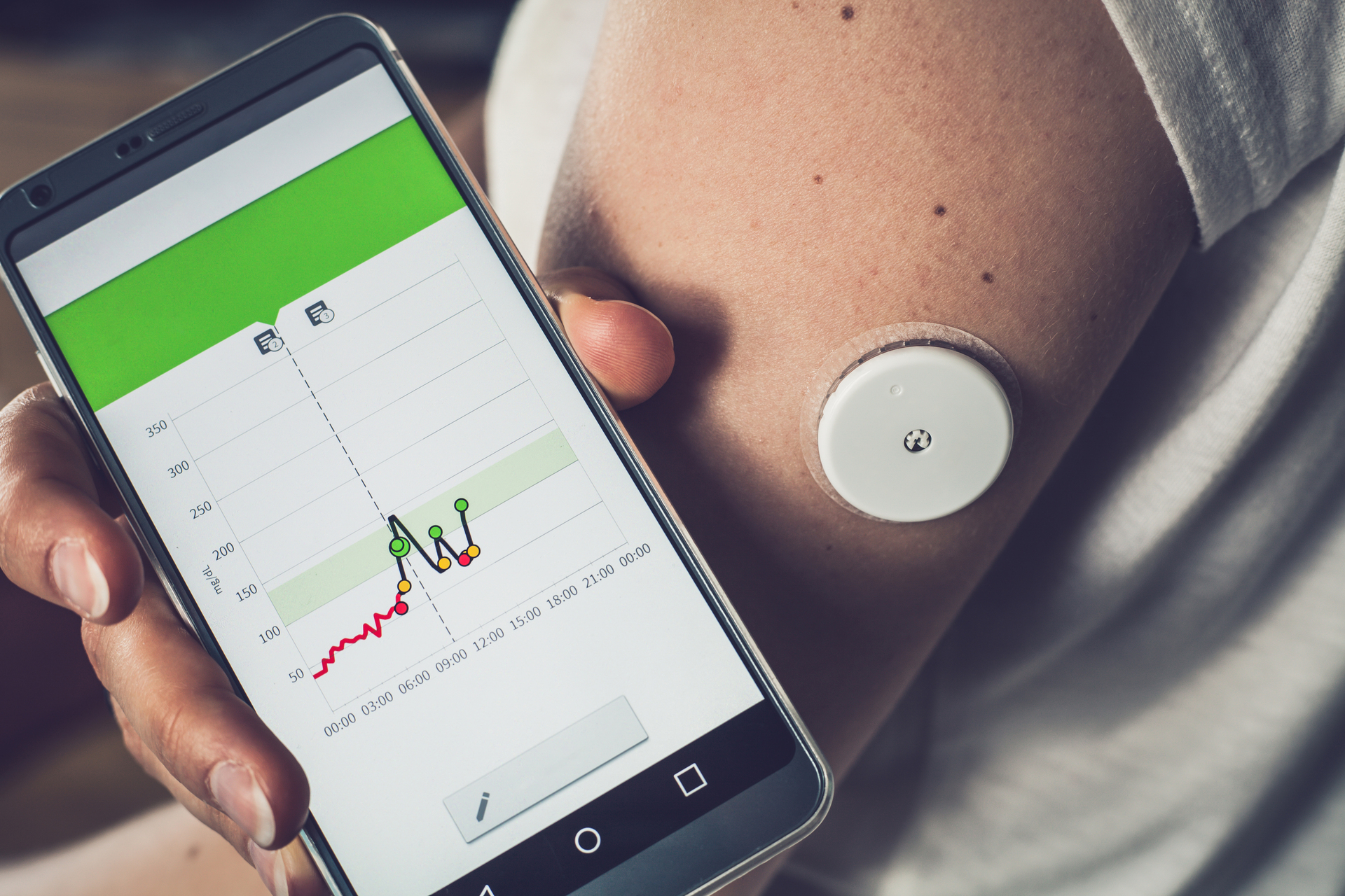 A new type of glucose monitoring system with an alarm is being released today. Photo / NZME