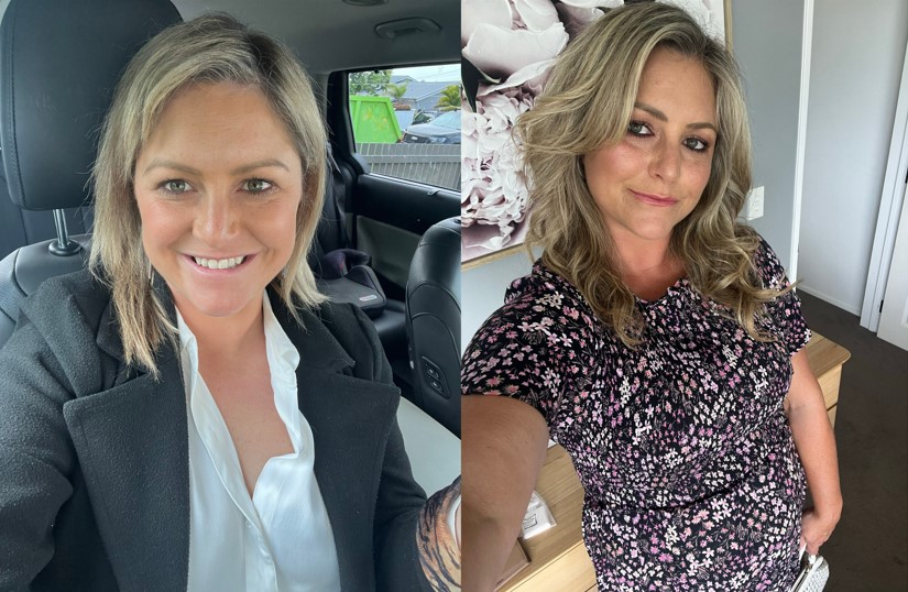Coast's Toni Street opens up on her podcast We Need To Talk about her hair loss.