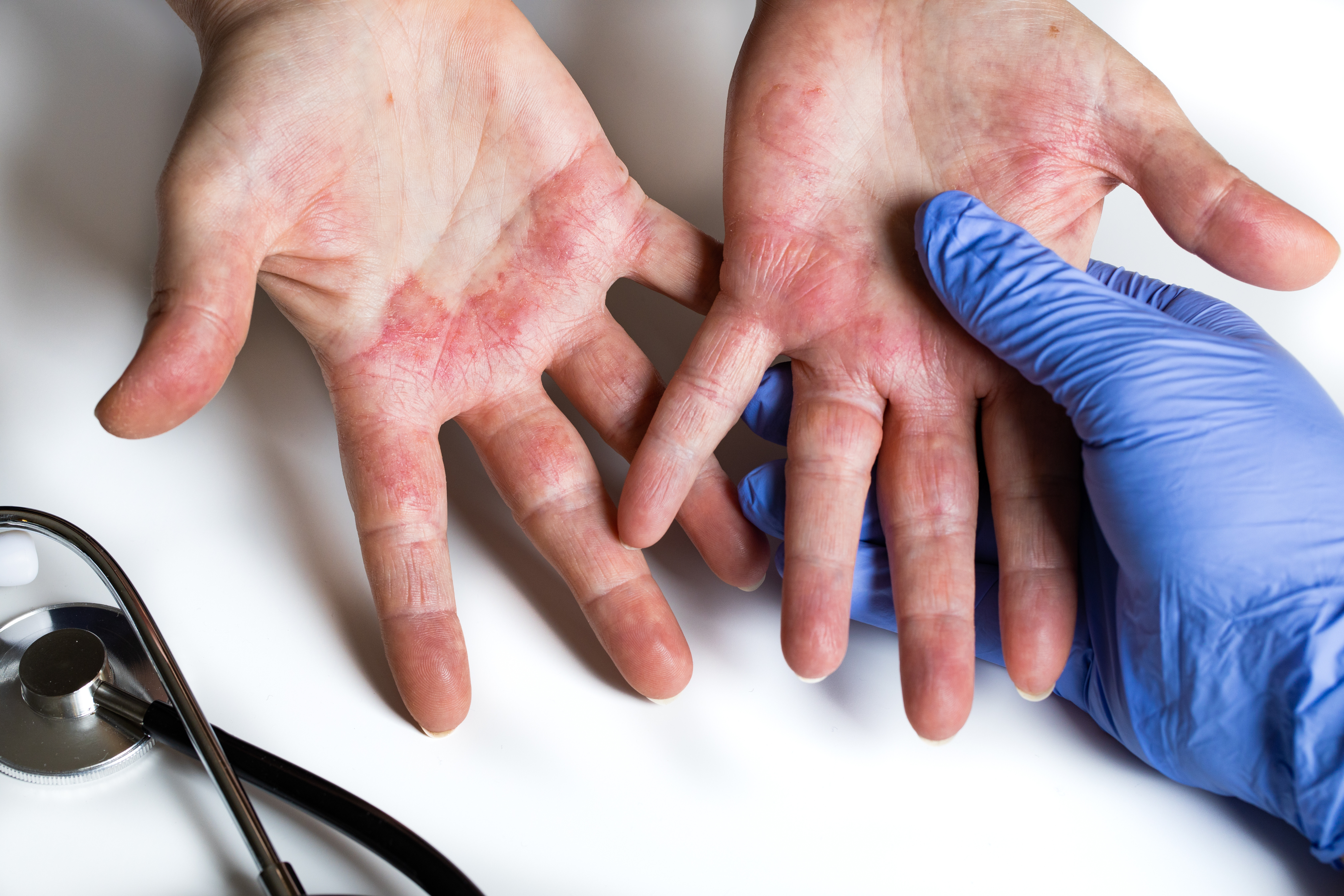 Northlanders are dealing with debilitating symptoms while waiting eight months on average for a specialist appointment. Photo / 123rf