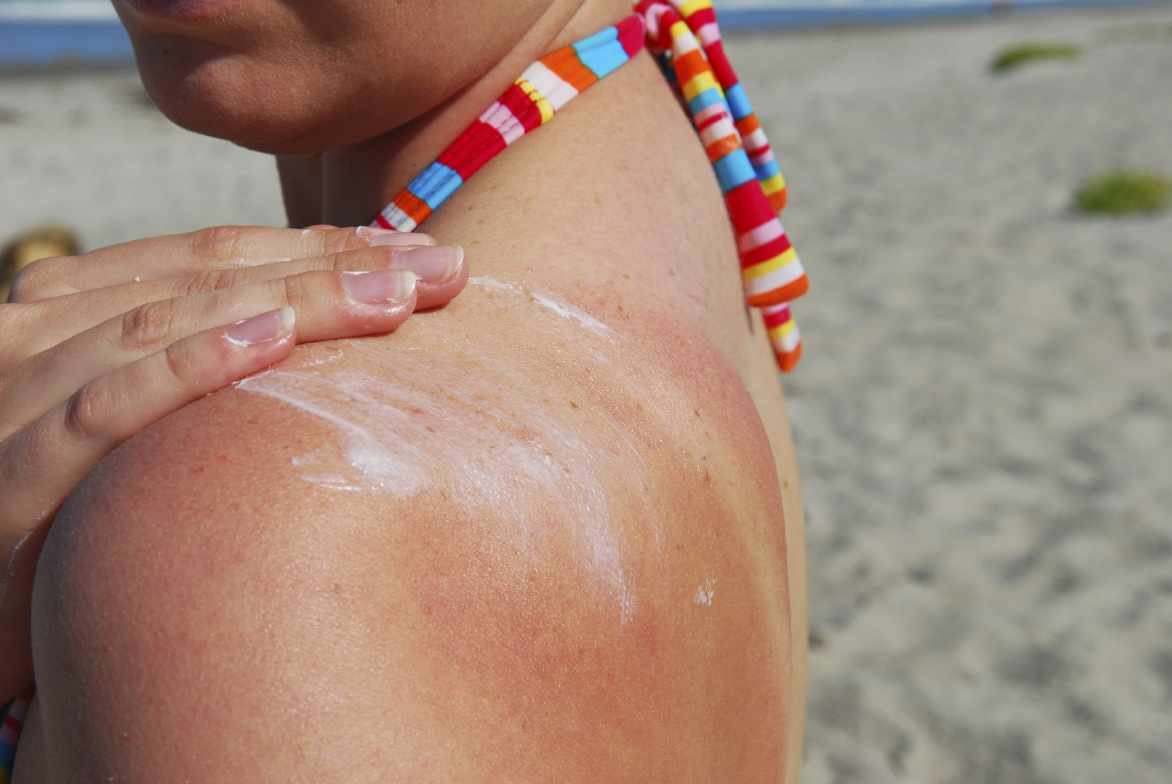 Lavender essential oil can also ease the pain and damage of burned skin, and accelerate healing. Photo / iStock