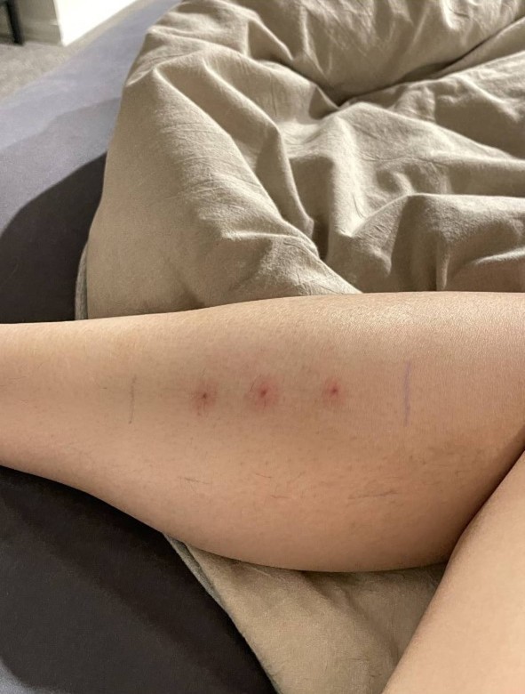 A North Shore woman has shared the results of a treatment that left her in excruciating pain. Photo / Supplied