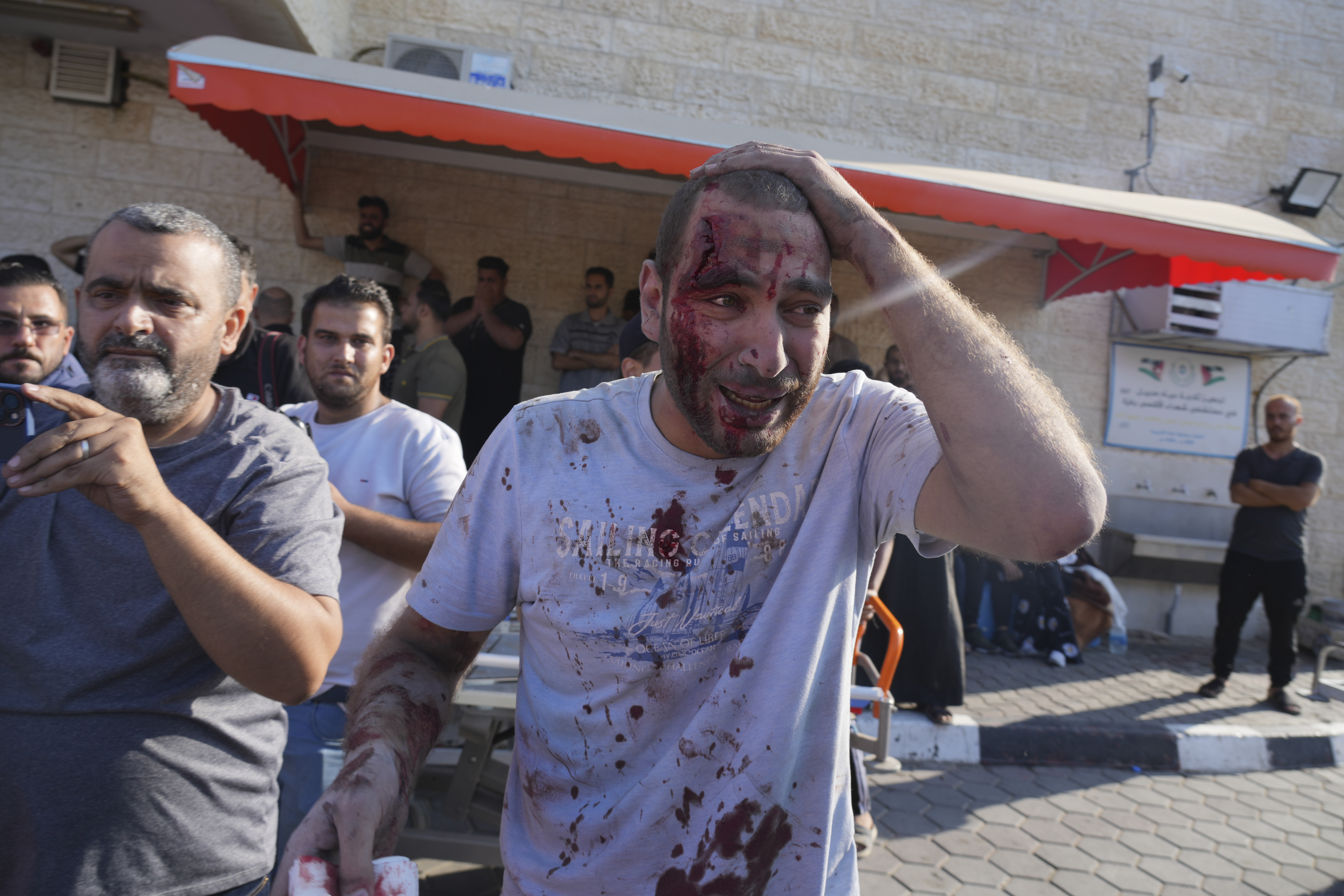 A Palestinian wounded in Israeli air strikes on Gaza Strip arrived at al-Aqsa hospital in Deir el-Balah City, Gaza Strip. Photo / AP