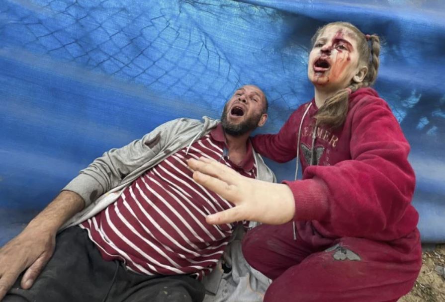 Wounded Palestinians react after an Israeli strike on Al Zawayda, central Gaza Strip. Photo / AP