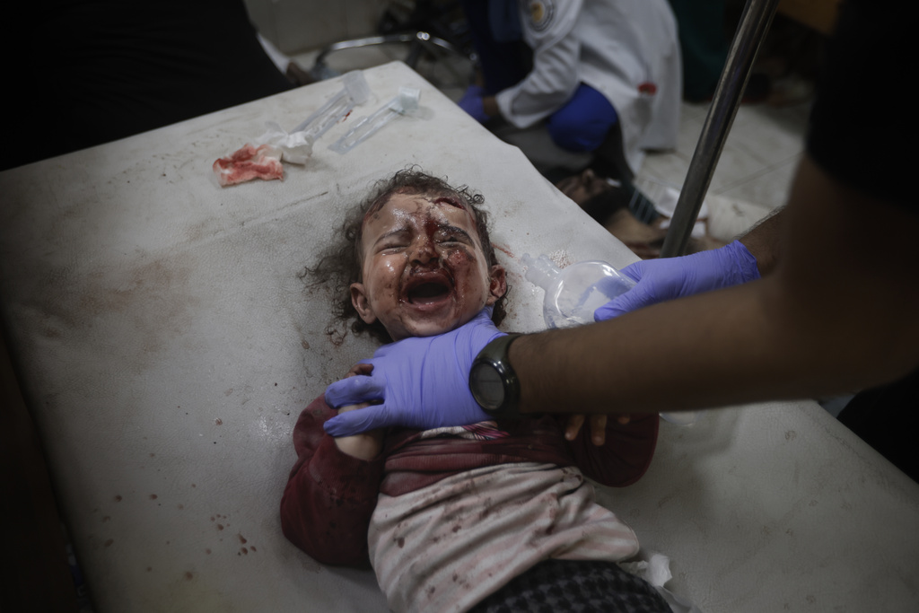 A Palestinian child wounded in the Israeli bombardment of the Gaza Strip is treated at a hospital in Khan Younis. Photo / AP