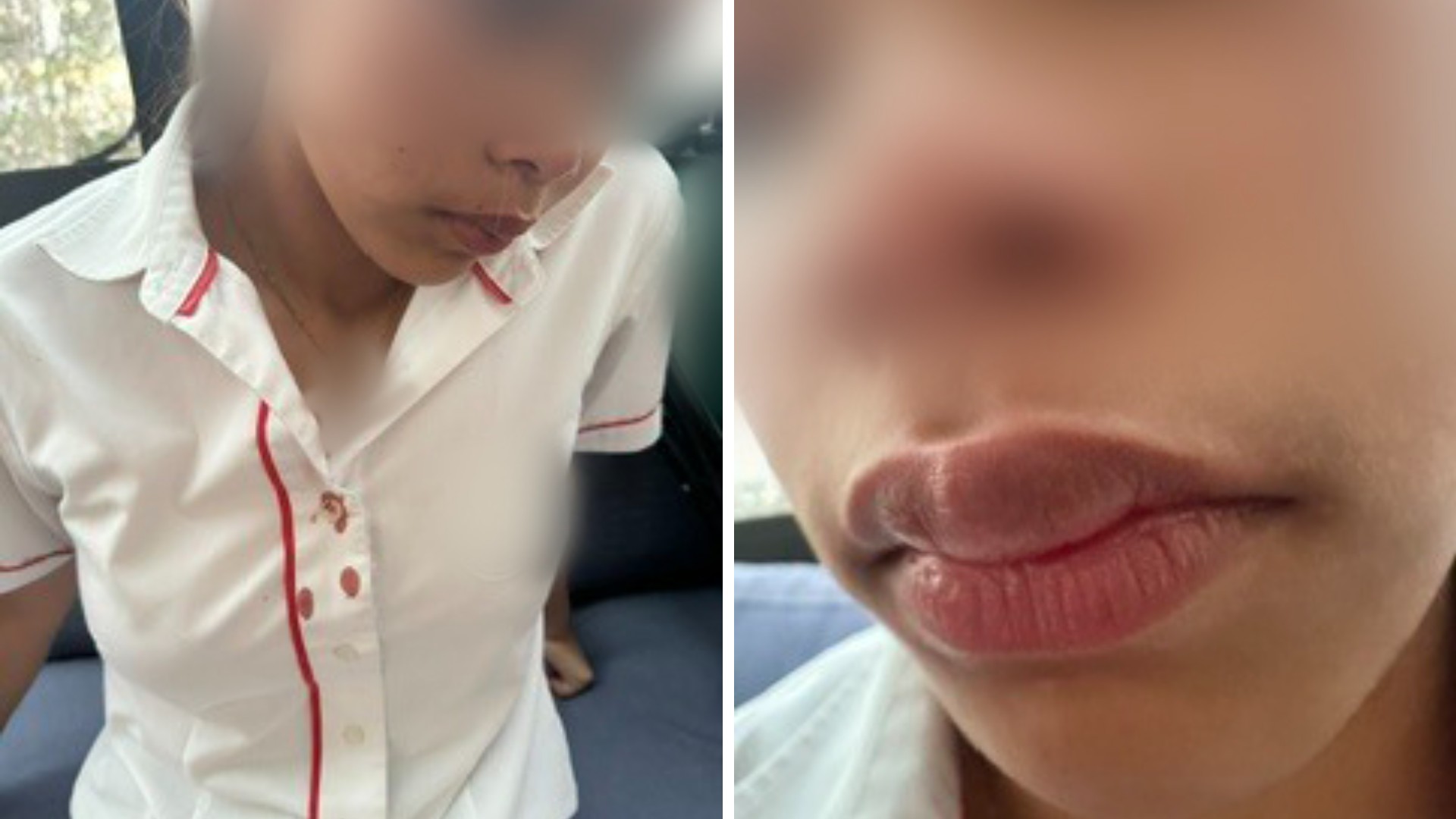 Chloe Rose Cantos was assaulted 