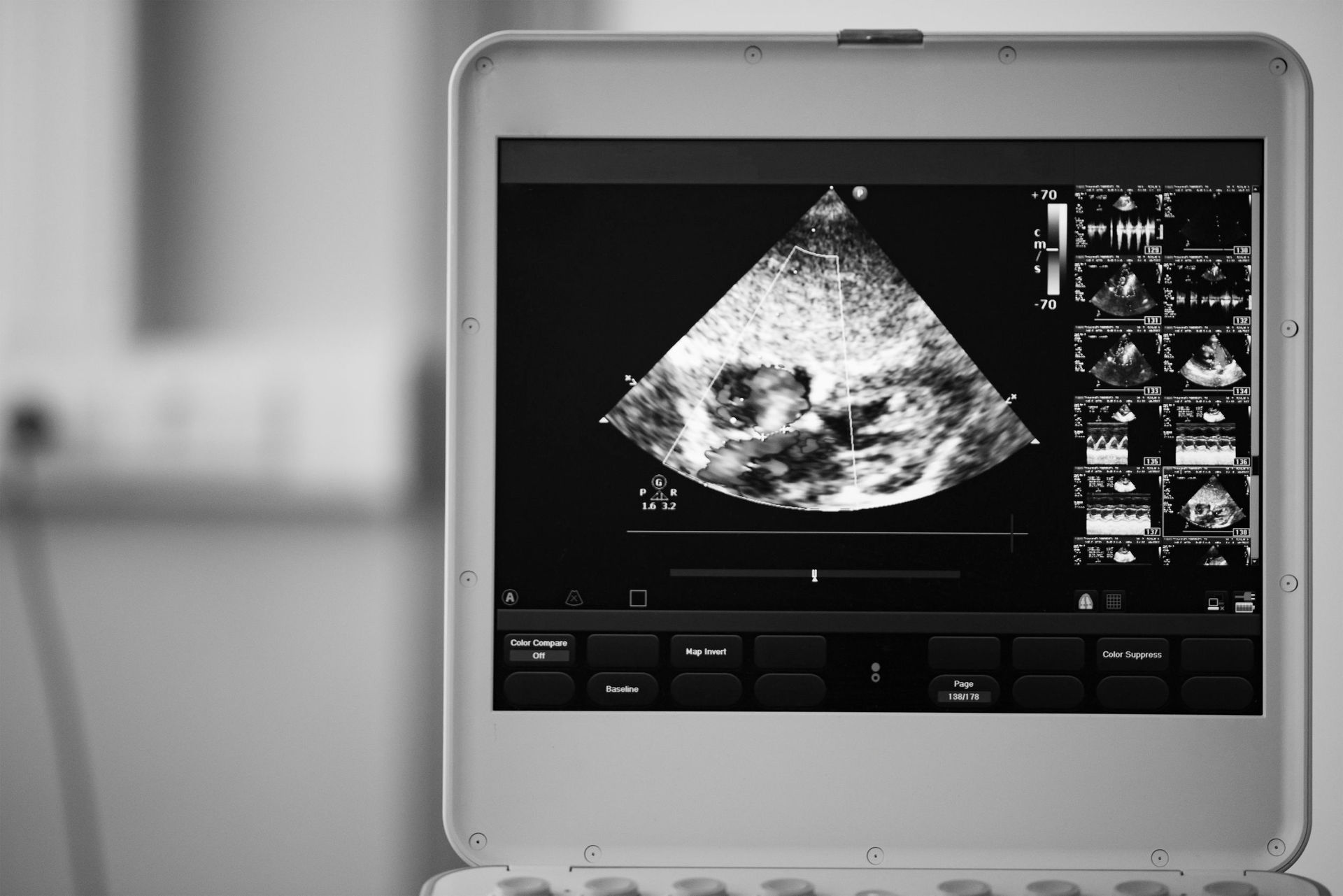 Wait times for heart ultrasounds for non-acute patients have built up. Photo / 123rf.com