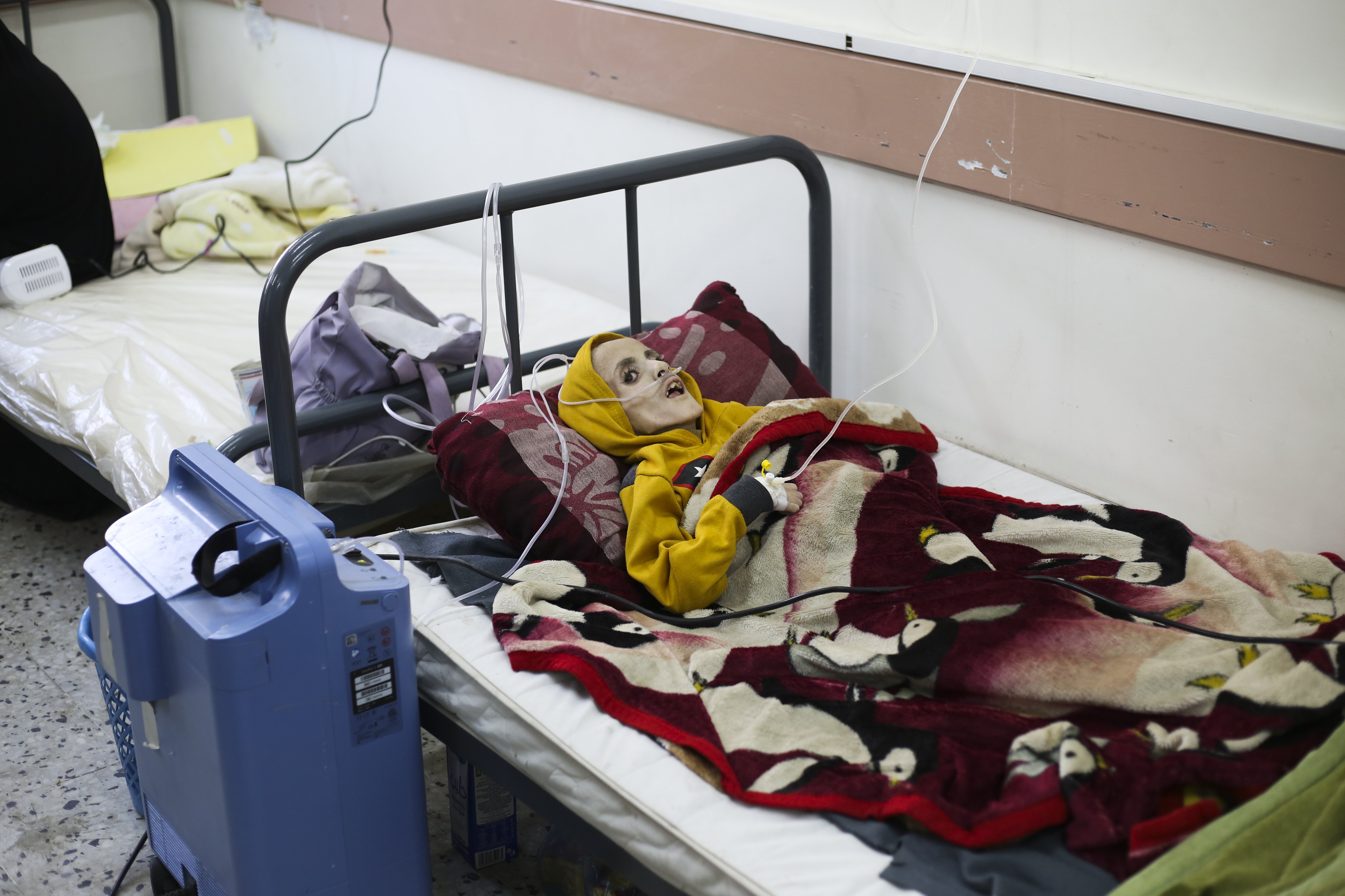 A 10-year-old Palestinian boy, Yazan al-Kafarna, who was born with cerebral palsy, died in a hospital in Rafah due to extreme muscle wastage caused mainly by a lack of food. Photo / AP